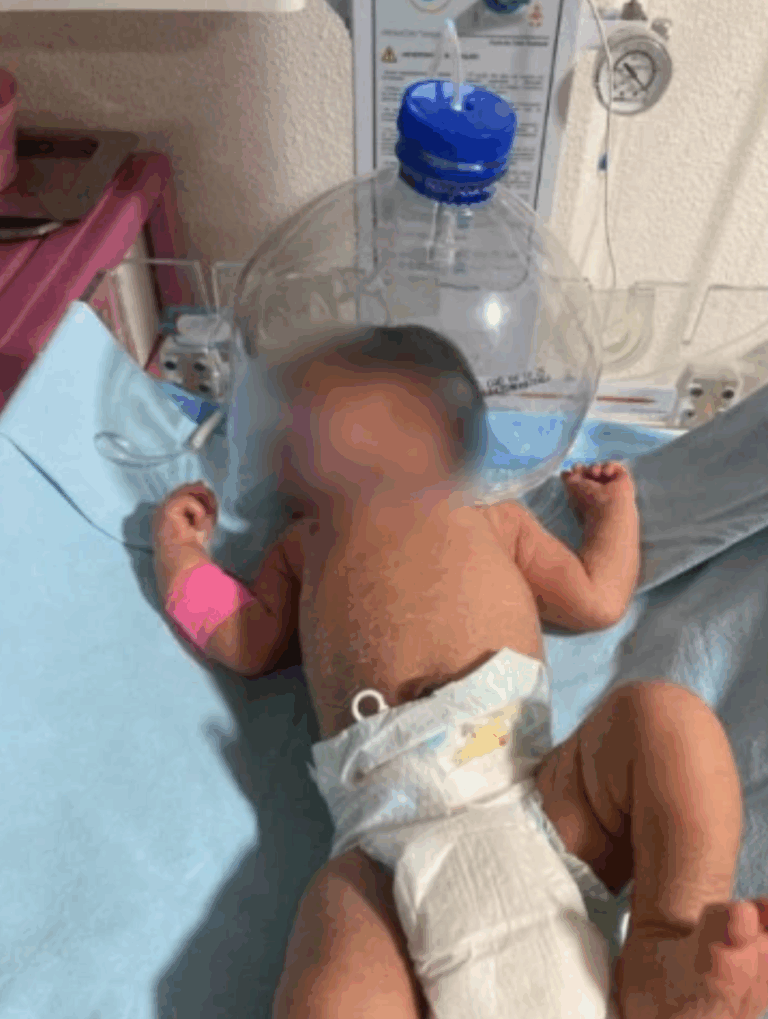 Por falta de insumos utilizan botella de plástico para salvar a recién nacido en Tabasco